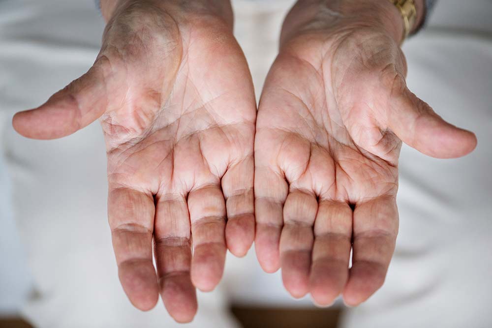 Guta la articulatiile degetelor de la mana Degetul arătător doare în articulație