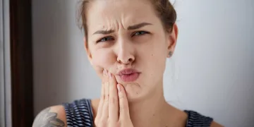 afte-bucale-tratament