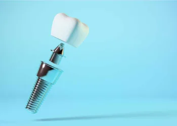 Implant dentar