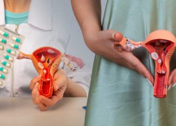 chisturi-ovariene-tratament